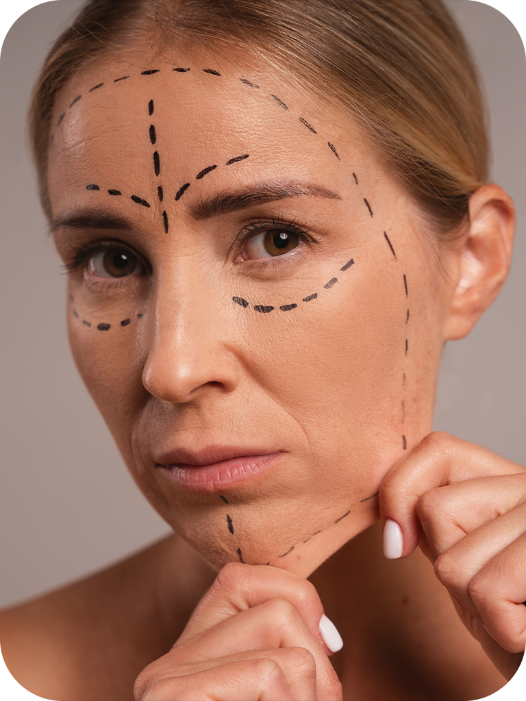 Tratamento Full Face Plastia